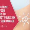 foods to avoid to protect from sun damage